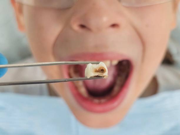 Best Emergency Broken Tooth Repair in Lawson Heights, PA